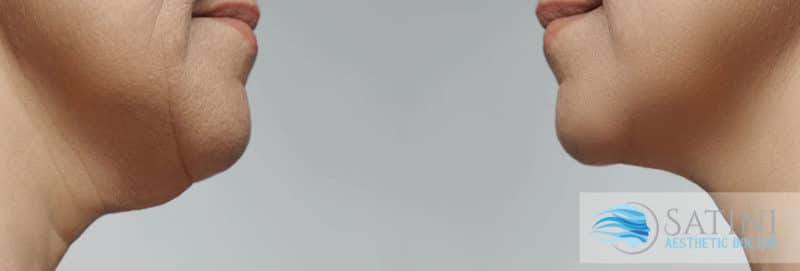 JawLine-Header-Image-800×271