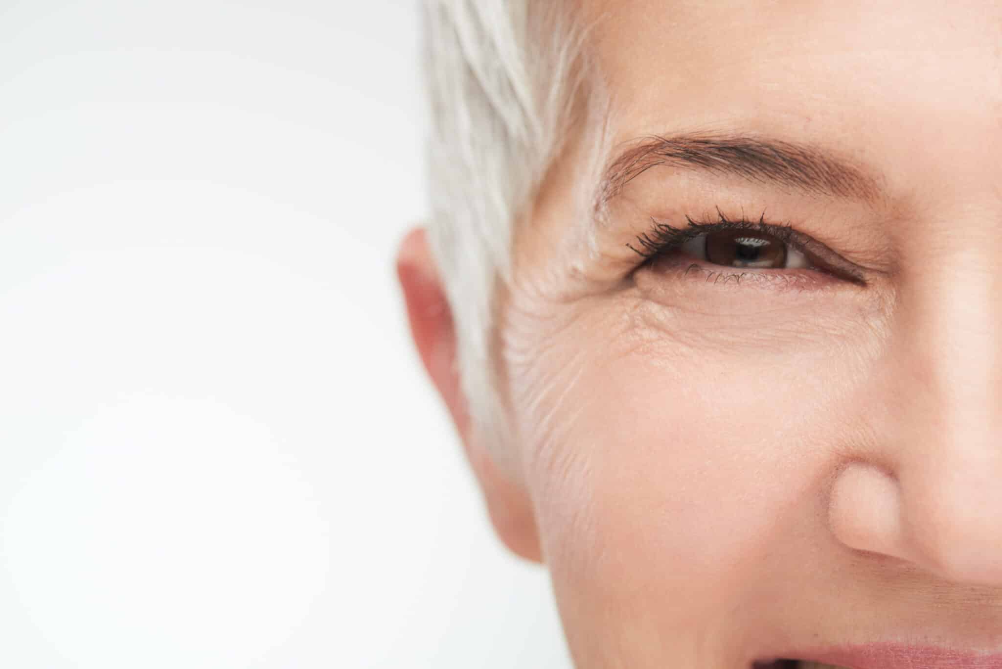 Dark circles under the eyes-Crow's feet-Saggy eyelids