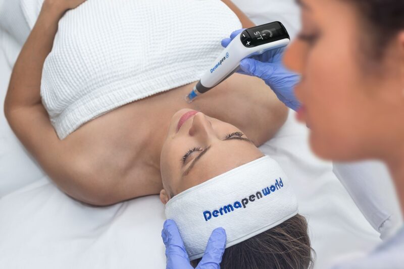 Microneedling Christchurch