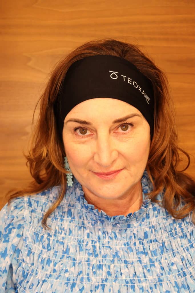 Botox treatments Middle aged woman who uses Botox