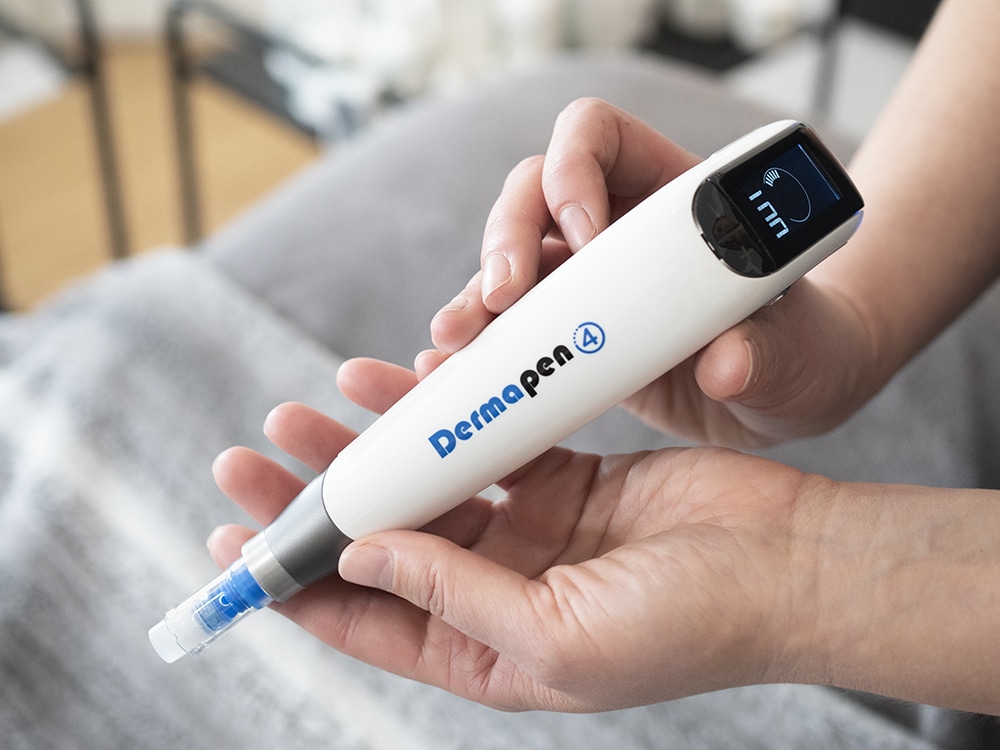 Microneedling Near Me-Microneedling Christchurch