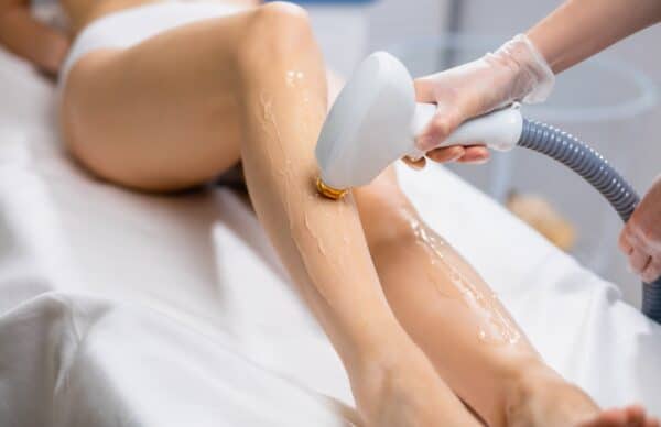 IPL Hair Removal IPL Hair Removal