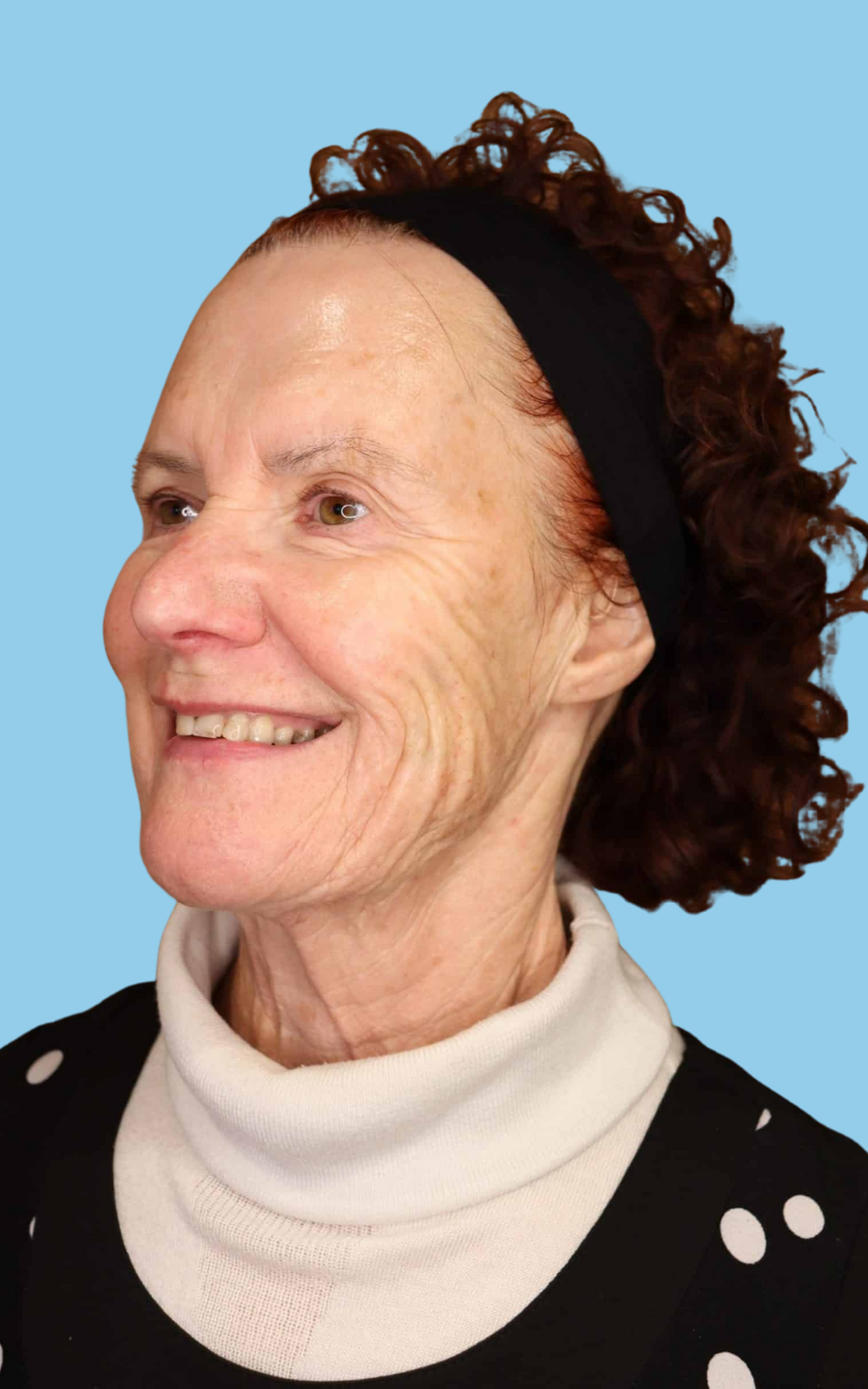 Glenda, a client at Satini Cosmetic Clinic Christchurch