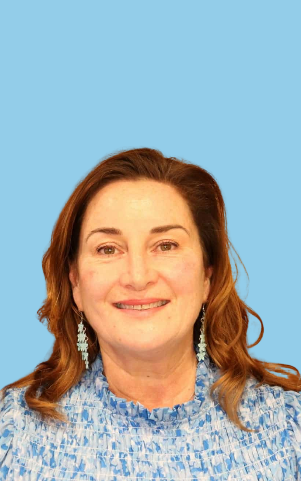 Annette looks refreshed after dermal filler