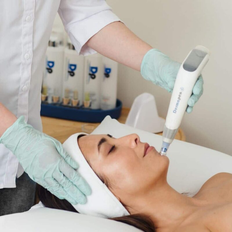 Microneedling with Dermapen 4 Microneedling Christchurch Packages