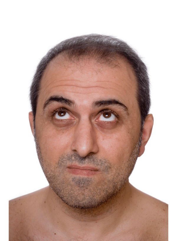 Hair Growth supplements NZ
