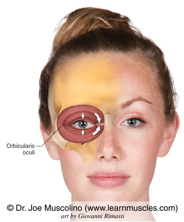 Botox for Crows feet and under the eyes