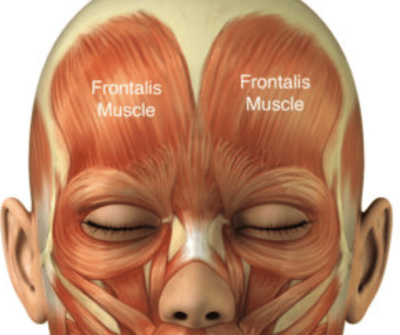 Forehead Botox Christchurch