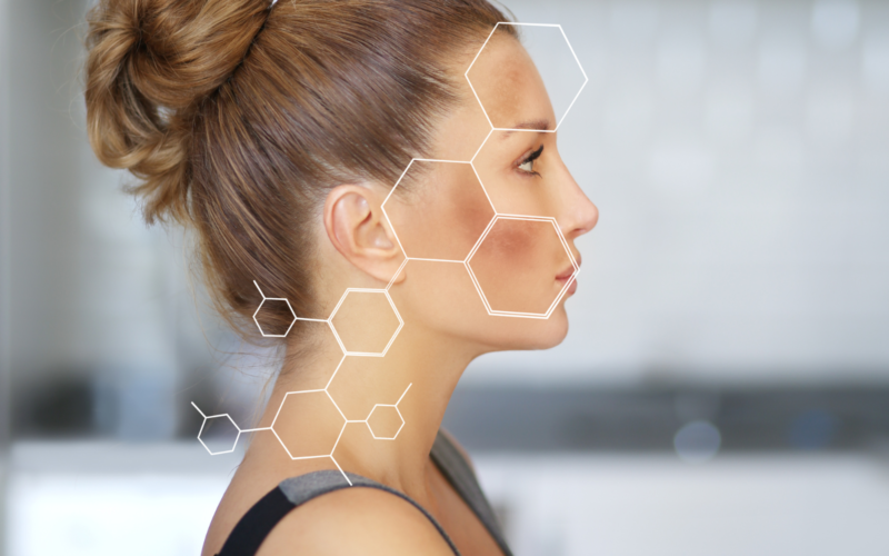 uneven Pigmentation Young woman with uneven pigmentation