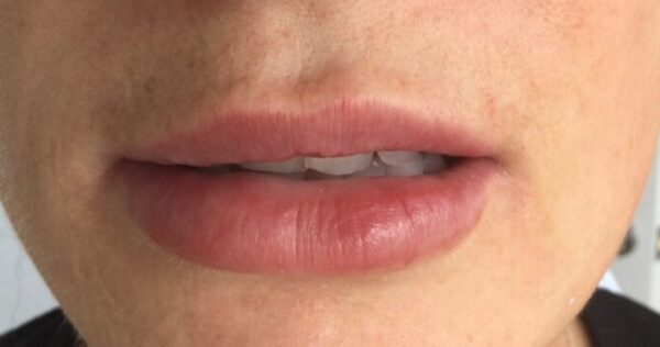 Before PDO Threads for lips