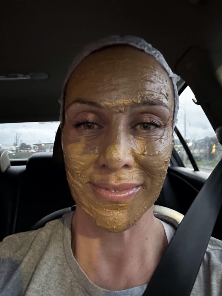 Jessie on her way home after the cosmelan mask Jessie going home after her cosmelan mask