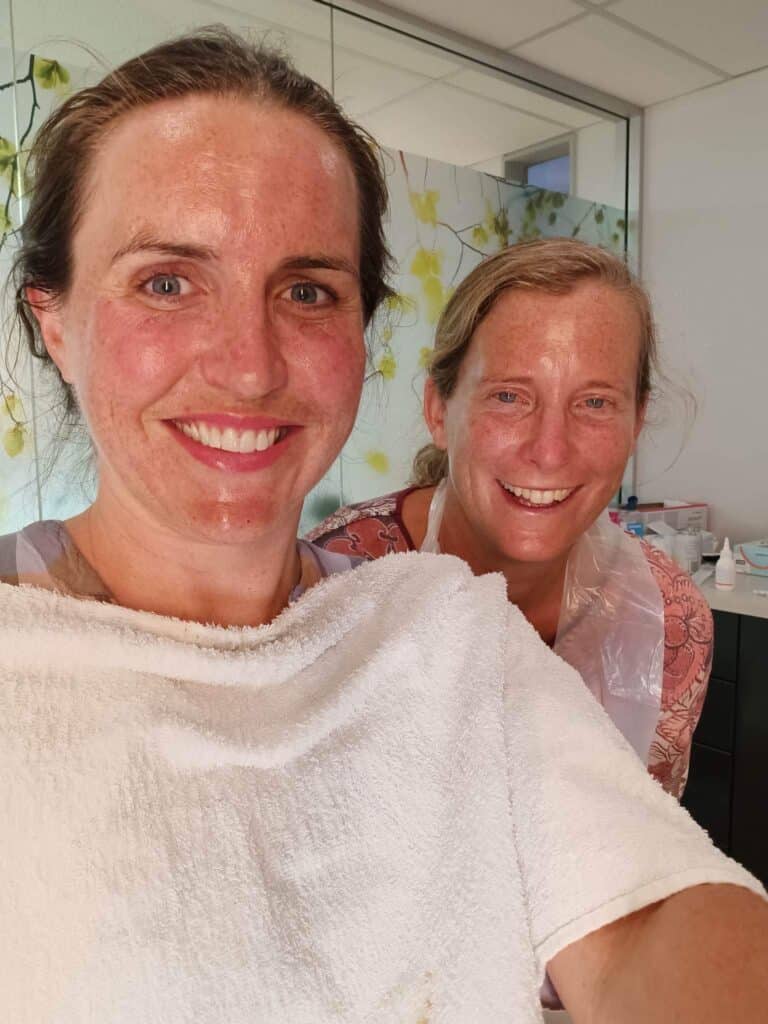 Karly and Dr Nadja Haub before a vampire facial