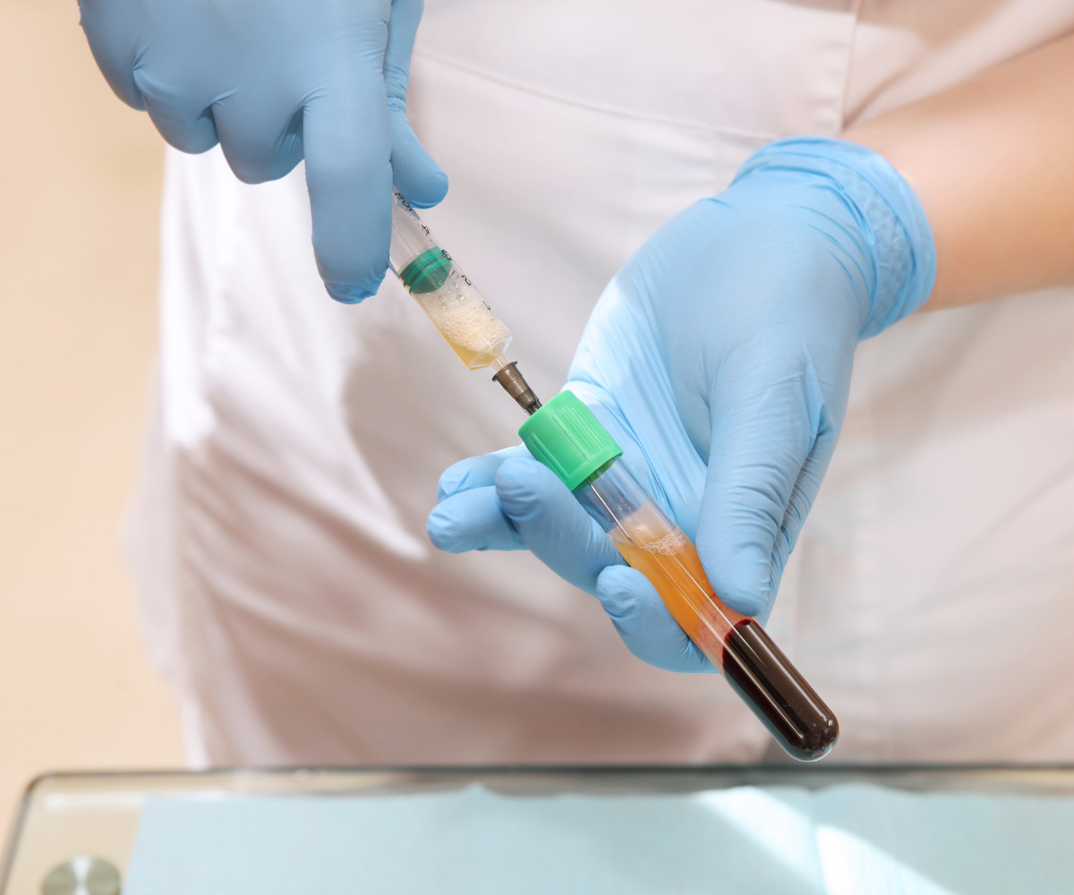 PRP Vial Of Plasma