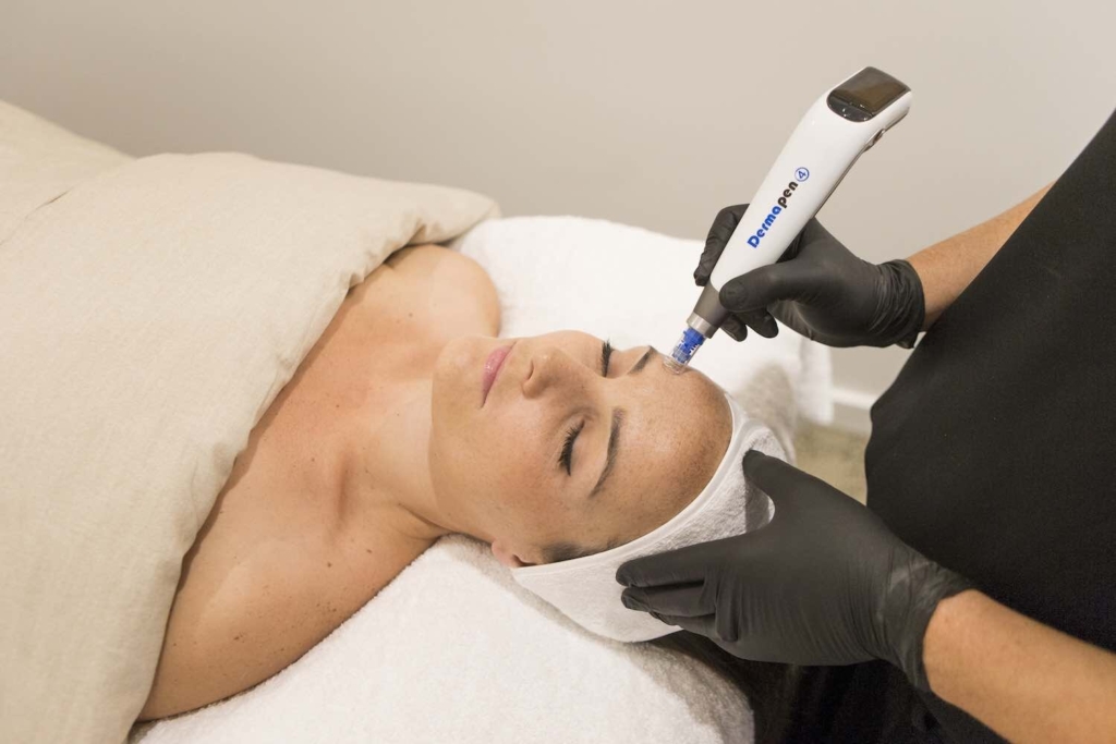 Dermapen microneedling