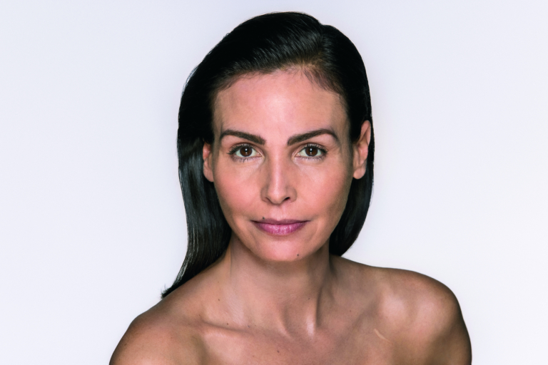 Middle Aged Woman Before Cosmetic Treatment