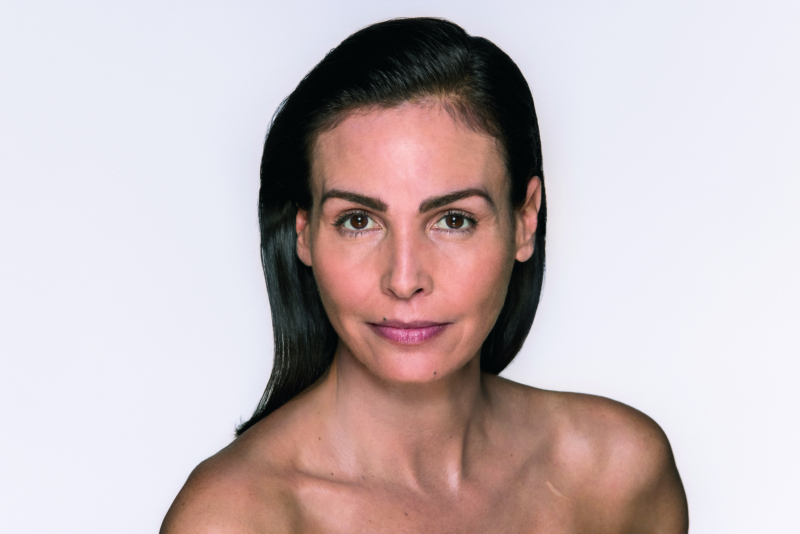 Middle Aged Woman Before Cosmetic Tretament Middle Aged Woman Before Cosmetic Treatment