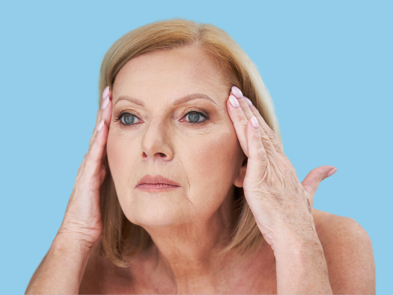 Mature woman before biostimulator treatment Mature woman before biostimulator treatment