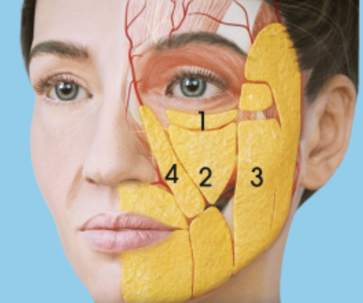 Superficial Facial Fat Pads Superficial Facial Fat Pads