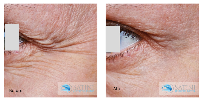 6f9ef283-fbe5-44b6-a5e7-5f308eef3d44